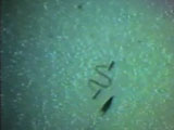Wound Closure with Staples