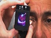 EyeQuick Digital Ophthalmoscope Camera: Affordable and Portable Ocular Photography
