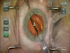 Thumbnail for resew