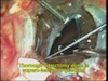 All in One - All Surgeries in One Case