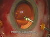 Vitrectomy for Stage II Macular Hole Without ILM Peel