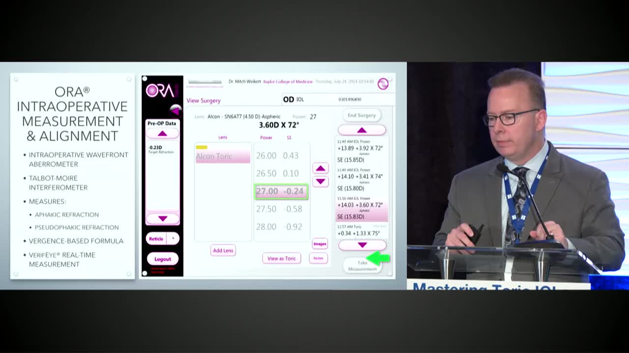Toric IOLs and Intraoperative Aberrometry