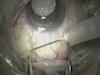 Mitomycin Injection