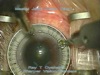 Micrometer LRI with Ring guide