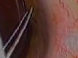 The Subluxed Lens: An Investigative Approach