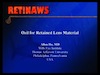 OZil for Retained Lens Material