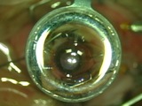 Optiflex Surgical Assistant in Action