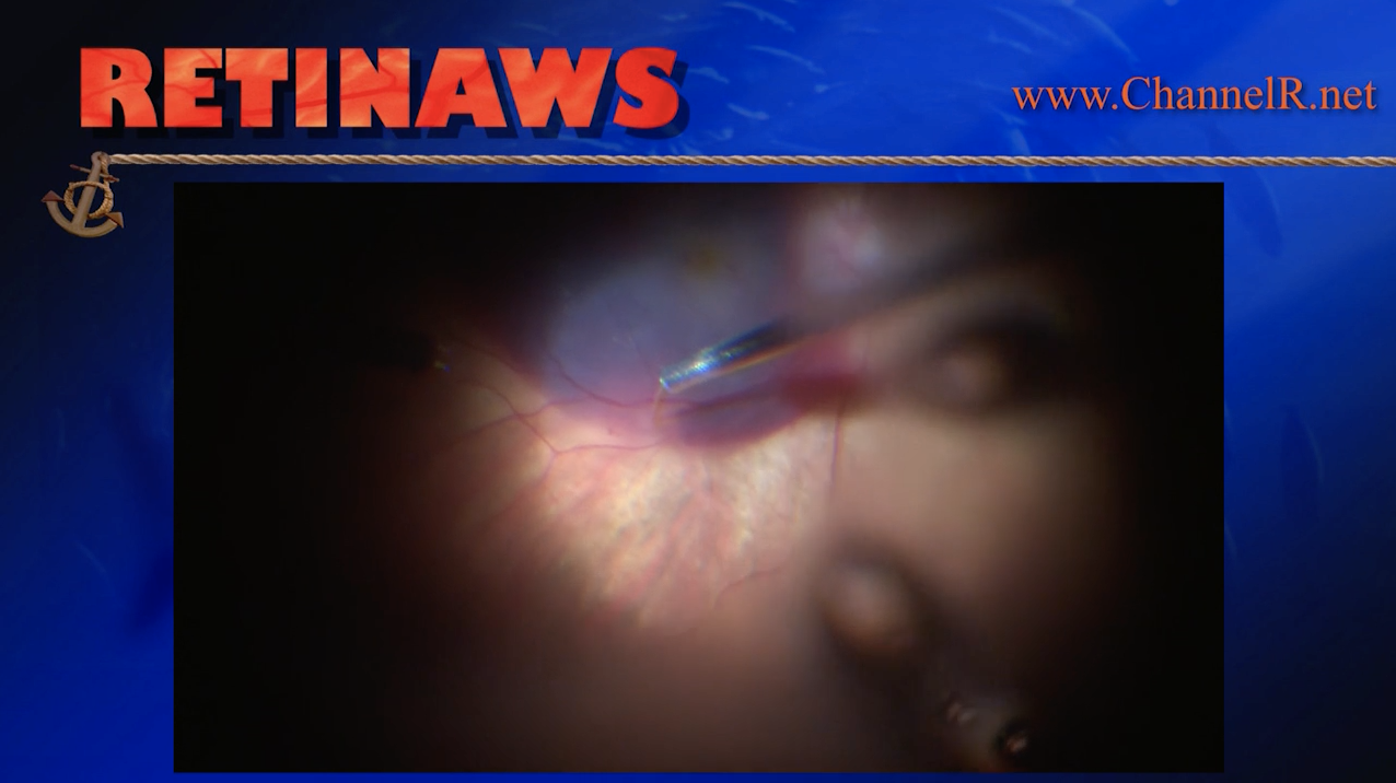 Thumbnail for sbjod