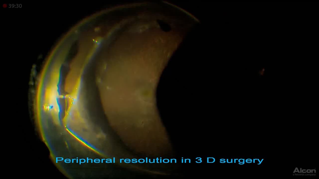 Improved Peripheral Resolution