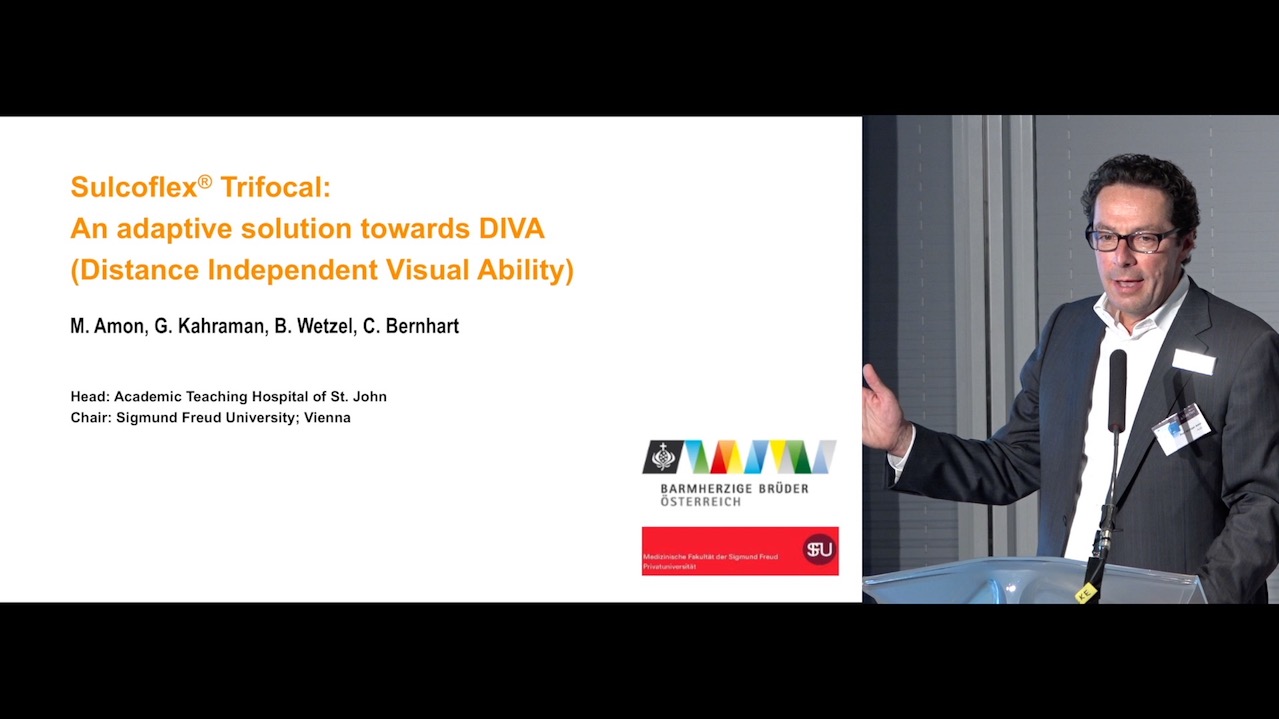 Sulcoflex Trifocal: History, Technique, and Preliminary Results 