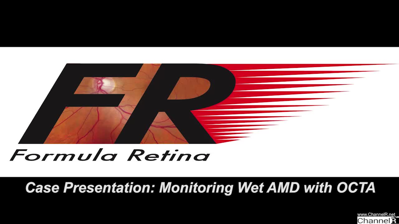 Case Presentation: Monitoring Wet AMD with OCTA