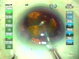 Understanding the Dropped Nucleus