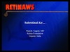 Subretinal Air