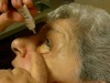 Glaucoma Drop Operator Error