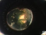 Photographing zonular behavior