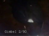 Small Pupil Phacoemulsification