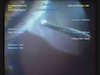 Vitrectomy for GRT with Ultra High Speed Cutting