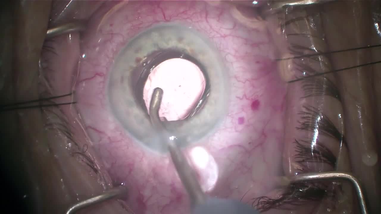 enVista Preloaded System Instructional Video