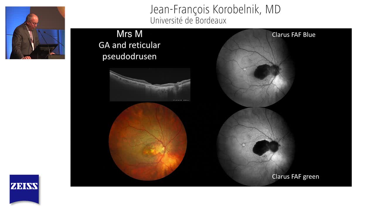 Prof. Korobelnik Reviews Fundus Autofluorescence Images Taken on ZEISS CLARUS 500