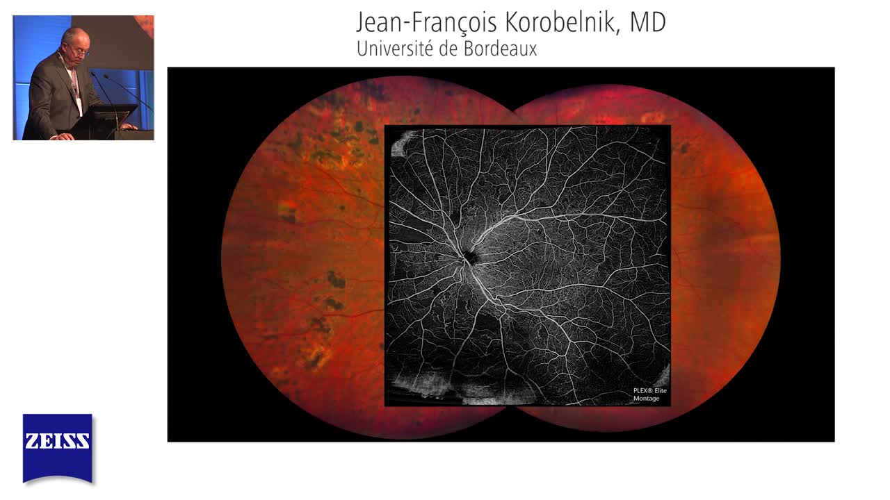 Enhancing the Power of Multi-Modality Imaging with ZEISS CLARUS 500