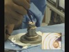 DSAEK with Moria CBm, Artificial Chamber, Disposable Punch and Busin's Glide and Forceps