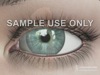 Cataract Description - Animated Patient Education