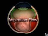 Aspiration Flow (French)