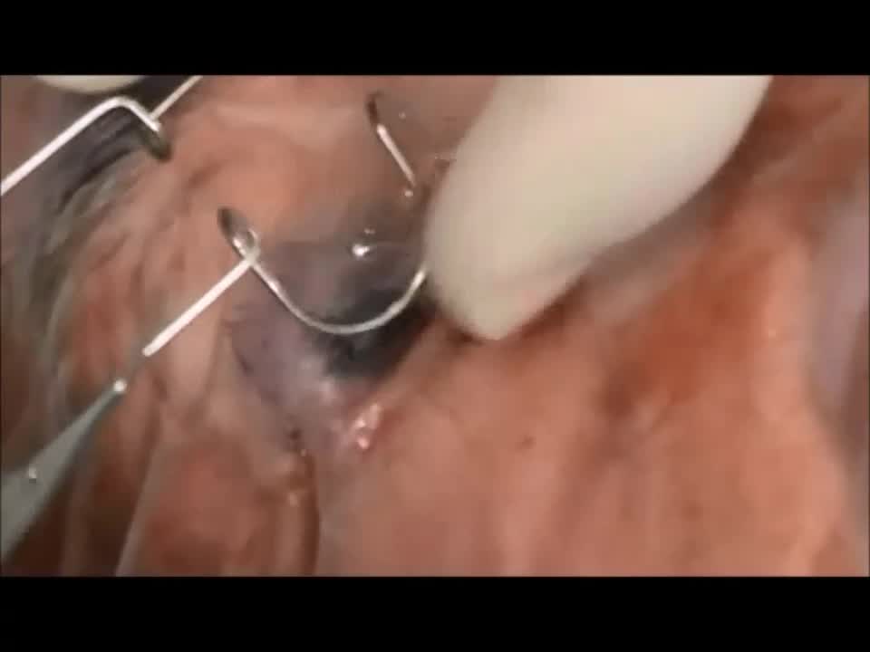 Ong Eye Speculum