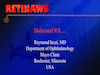 Dislocated IOL II