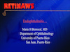 Endophthalmitis