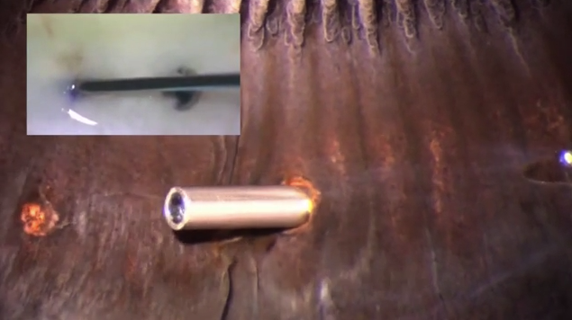 Removal of Small Gauge Cannulas