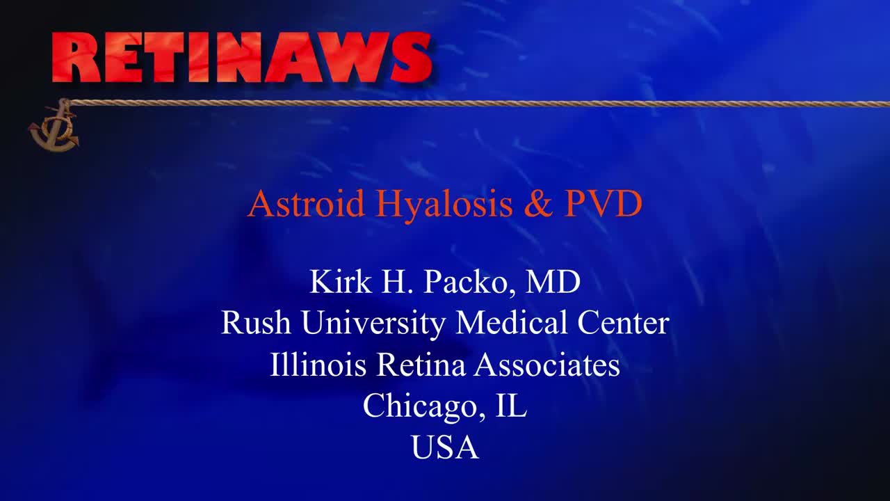 Astroid Hyalosis & PVD