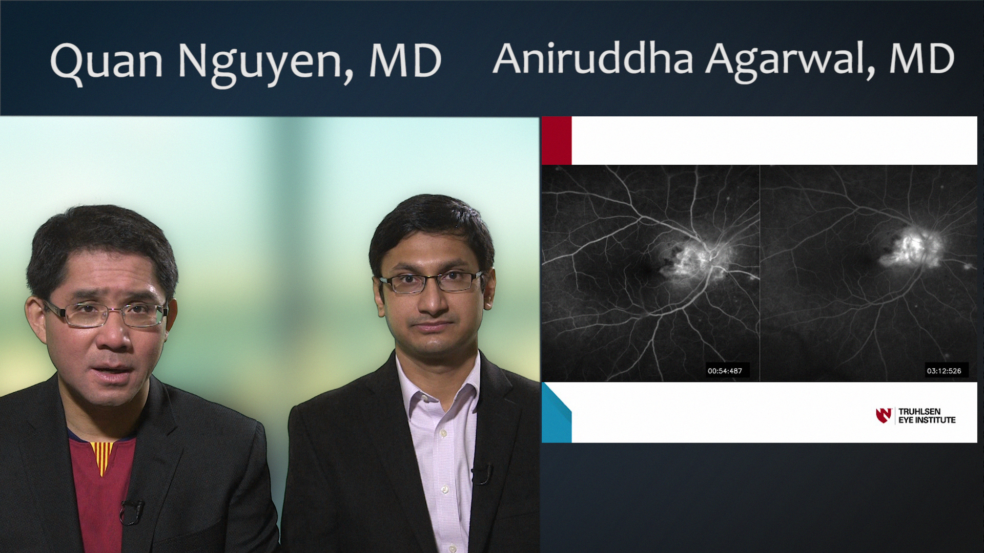 OCTA in the Management of Patients With Uveitis