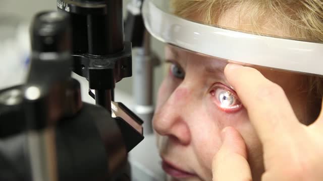 Treating Dry Eye with the eyeXpress