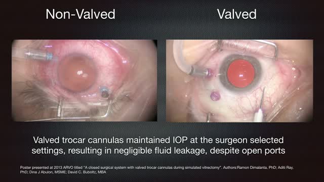 Improving Fluid Stability During MIVS 