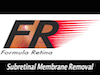Subretinal Membrane Removal