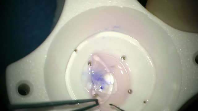 Small Incision Ultra-thin Cut DSAEK