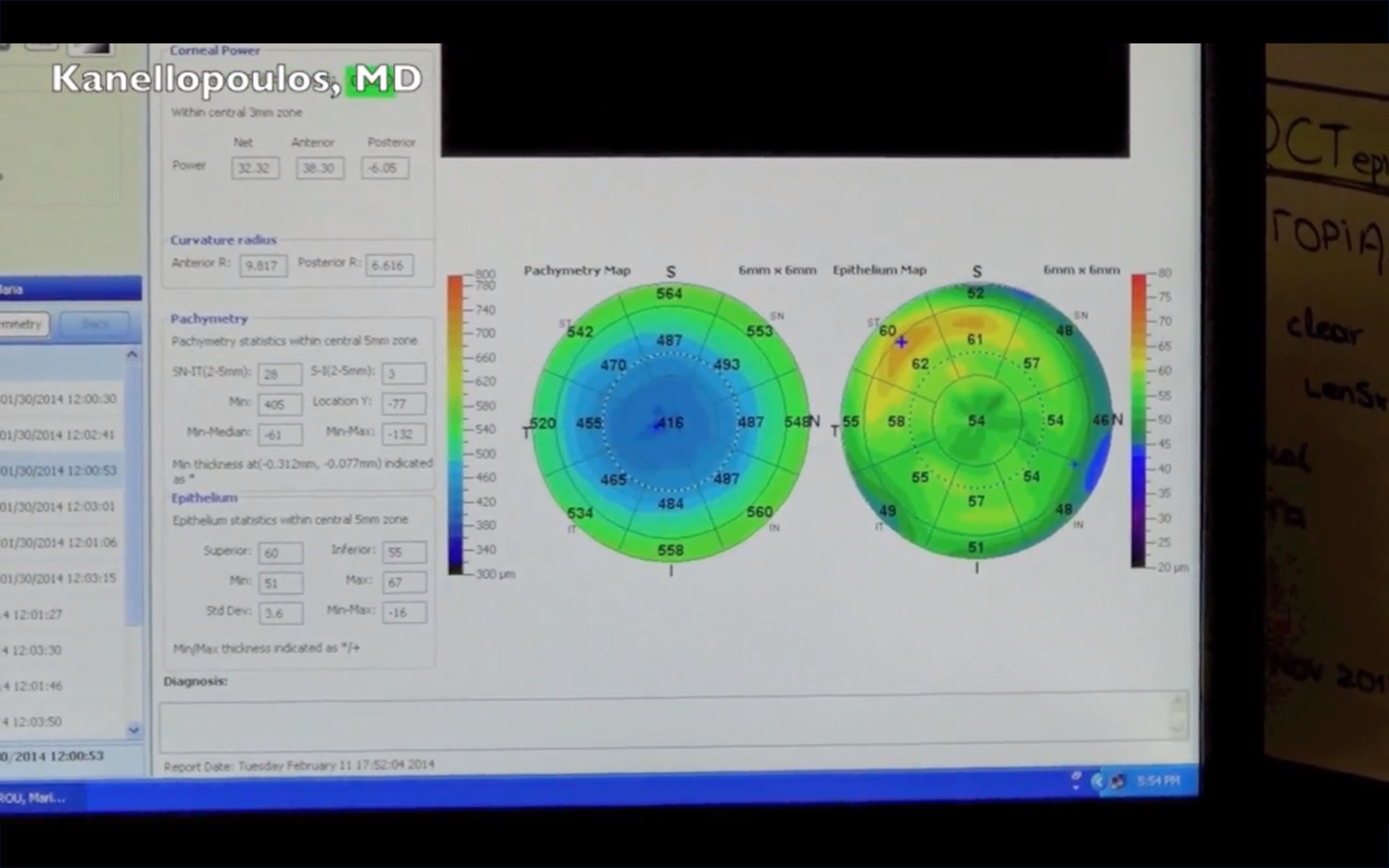 Review of Key Corneal Epithelial Profiles and Their Effects