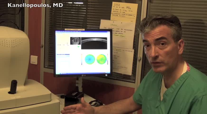 3D Epithelial Imaging by OCT