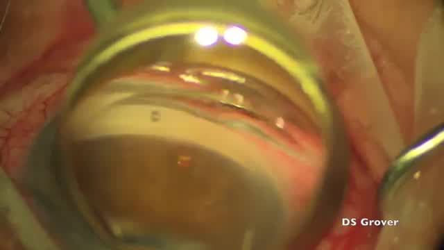 Novel CyPass Trimmers