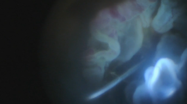 A Jellyfish in the Eye