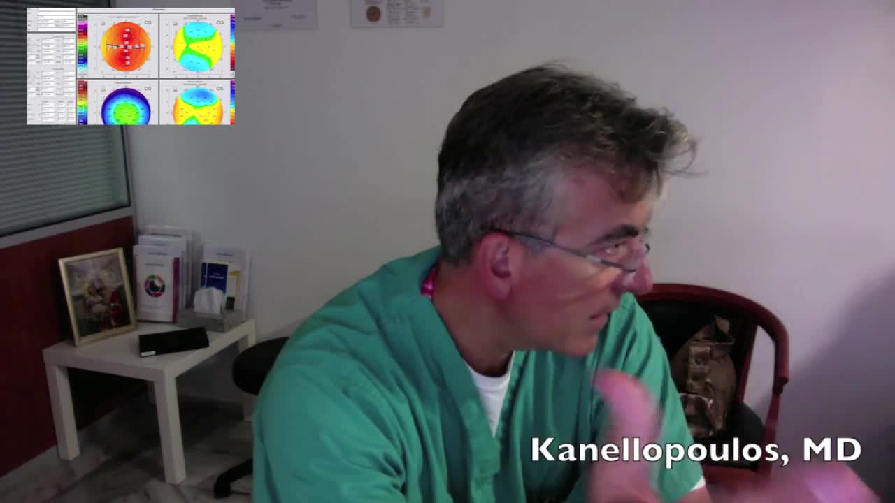 Keratoconus Consultation