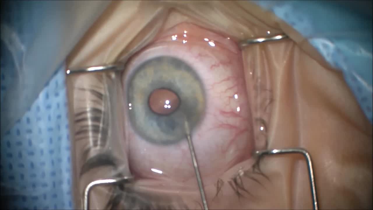An Unusual Case