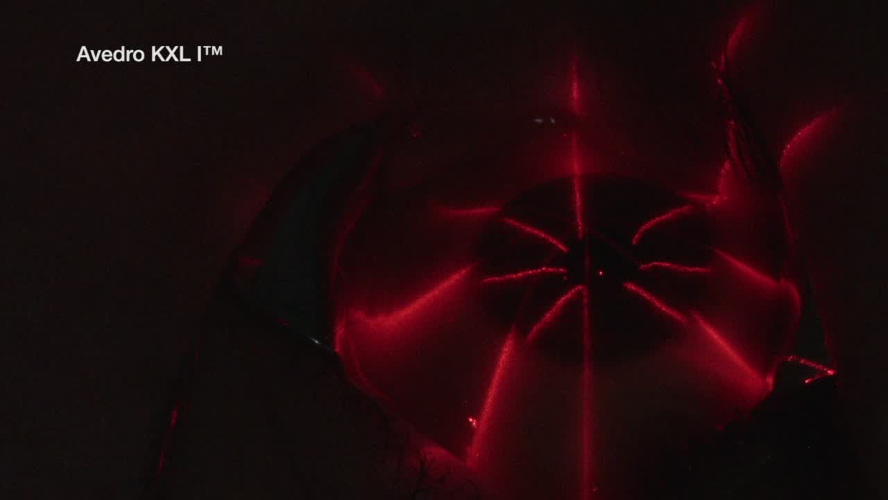 Corneal Collagen Crosslinking for Progressive Keratoconus with Epi-Bowman Keratectomy (EBK)