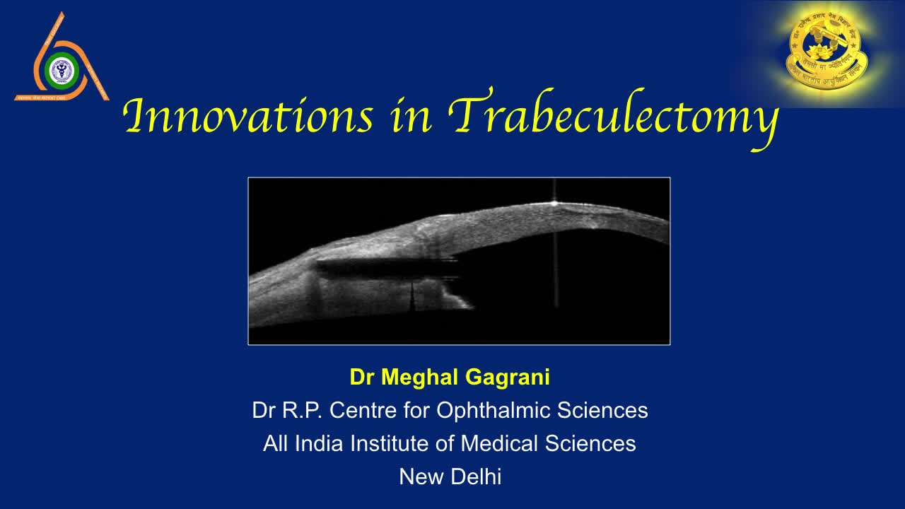 Innovations in Trabeculectomy