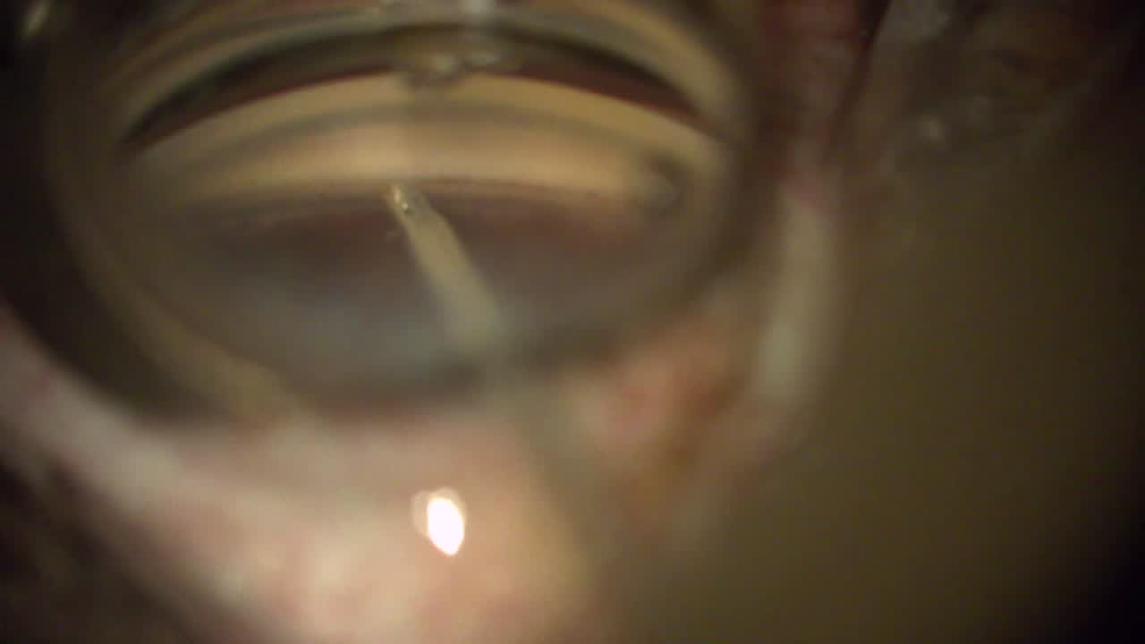 Thumbnail for uupgpek