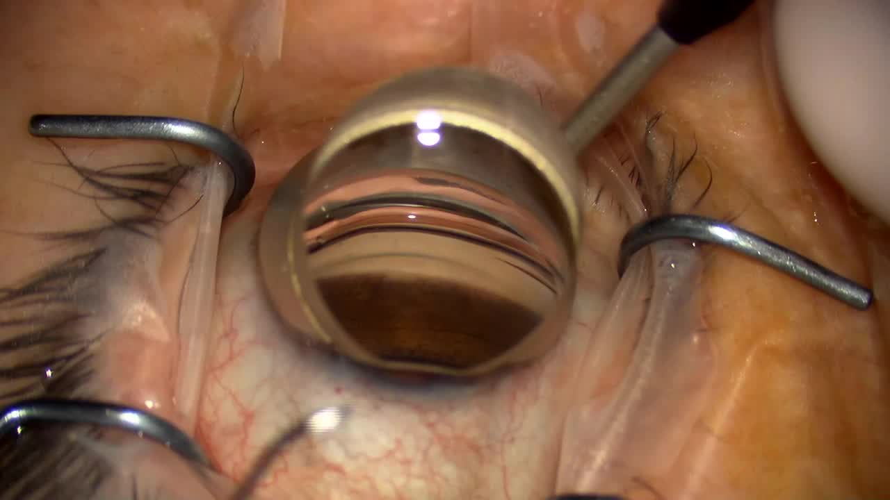 Hydrus: Don't Give Up