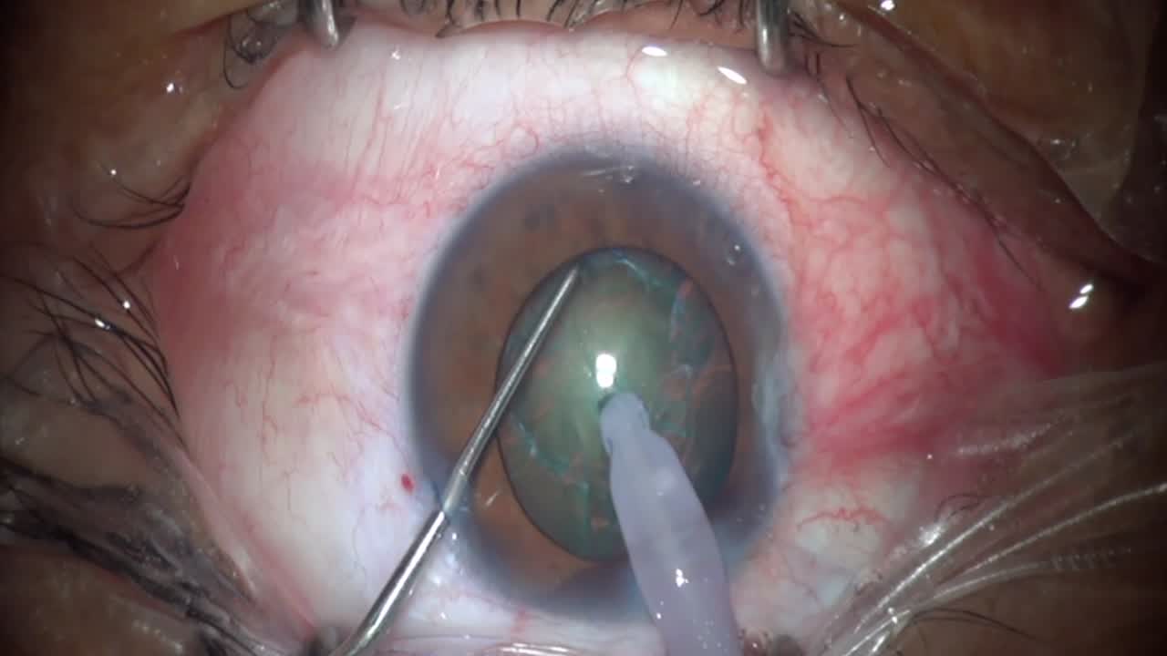 Vertical Quick Chop