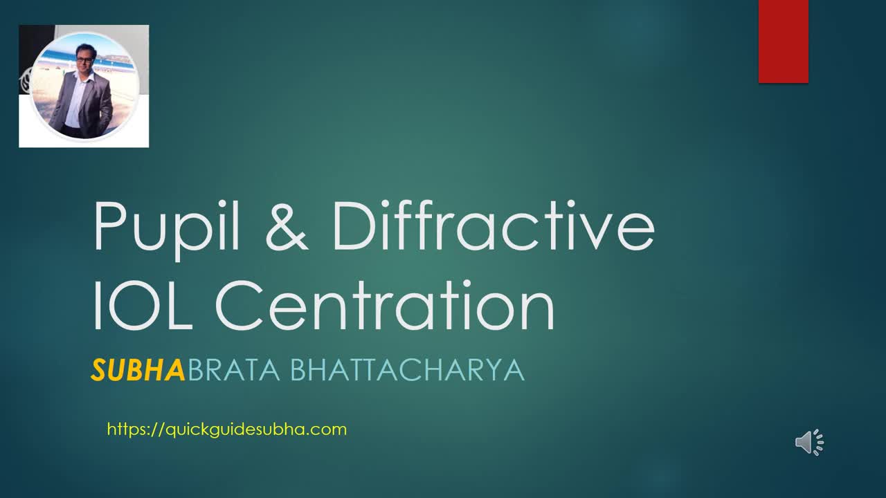 Multifocal Diffractive IOL Centration 