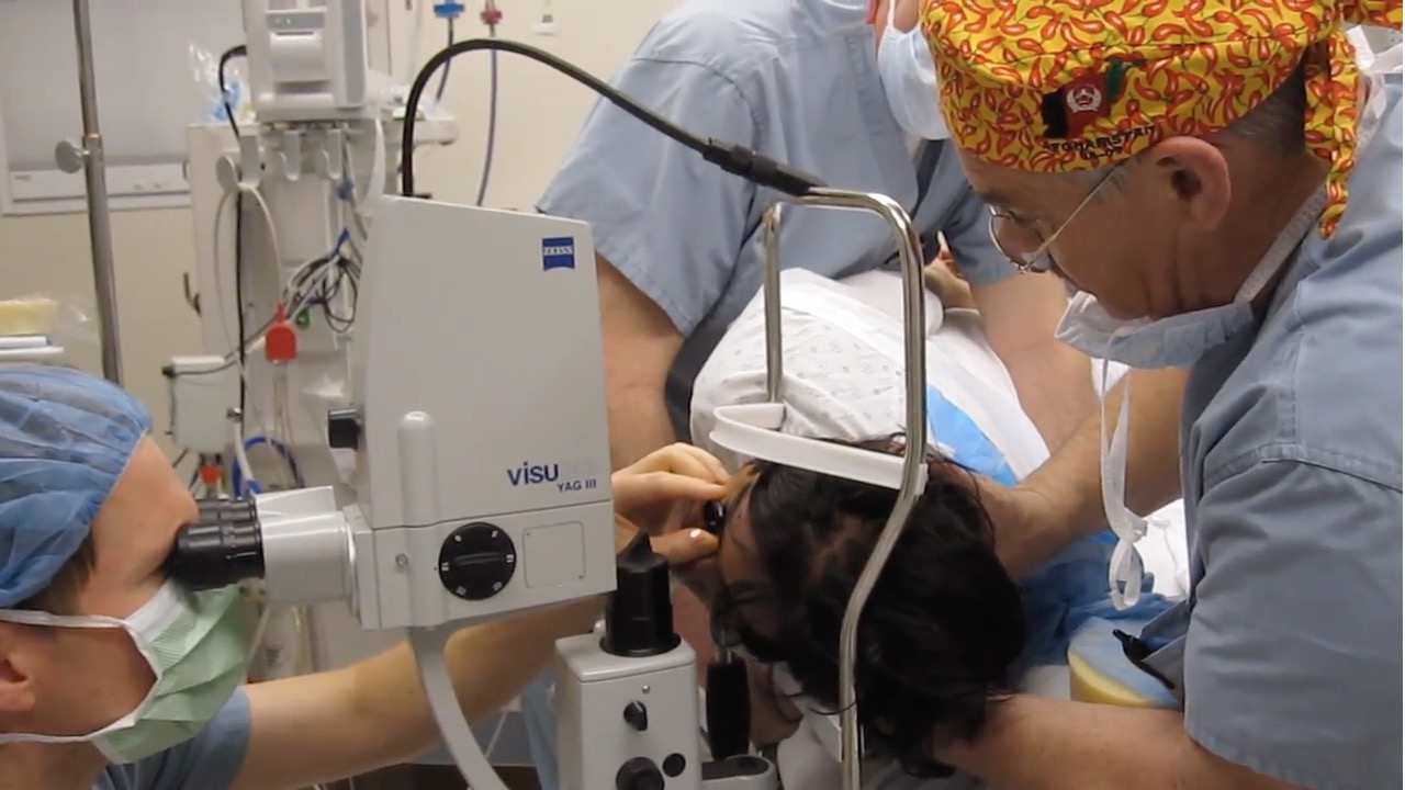 Lateral Decubitus Position for Pediatric YAG Capsulotomy